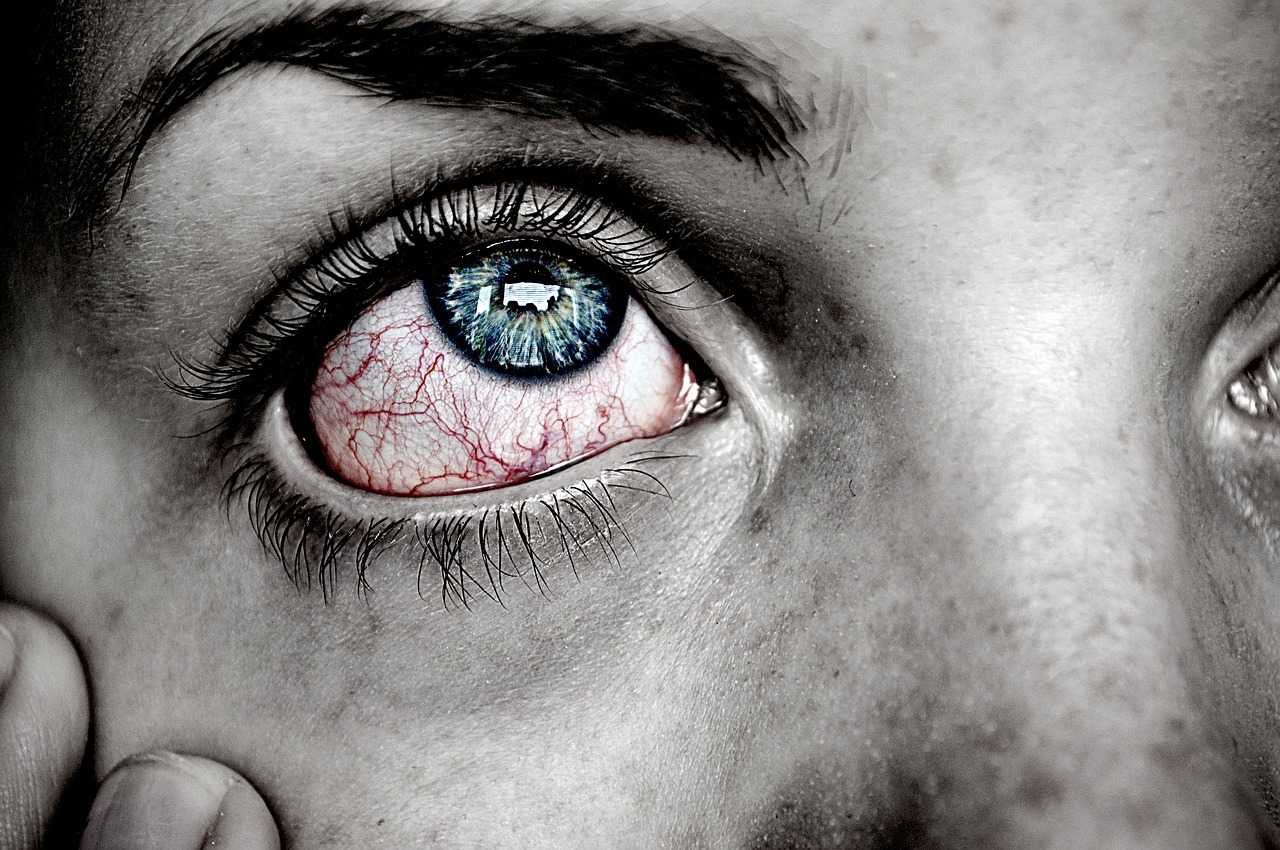 Rote Augen nach Schlafen: Ursachen, Symptome und Behandlung